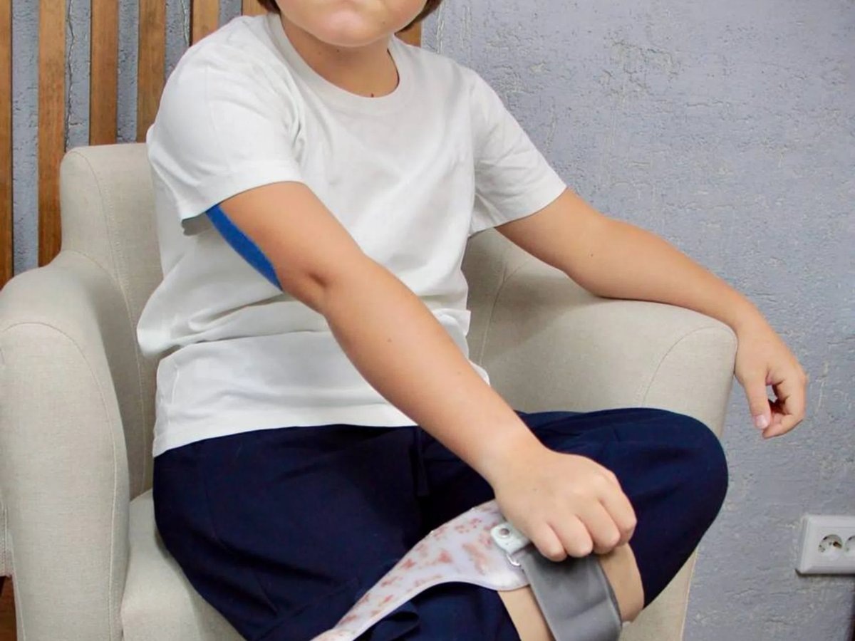    Окончательный диагноз Андрею был установлен в возрасте восьми лет