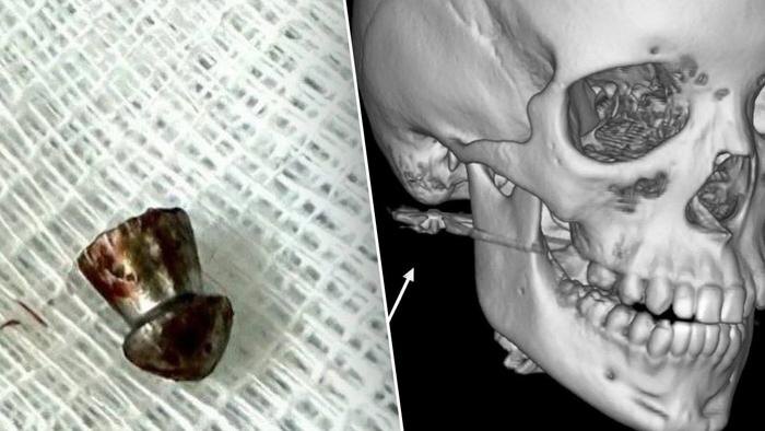 Обложка © Telegram / Amur Mash