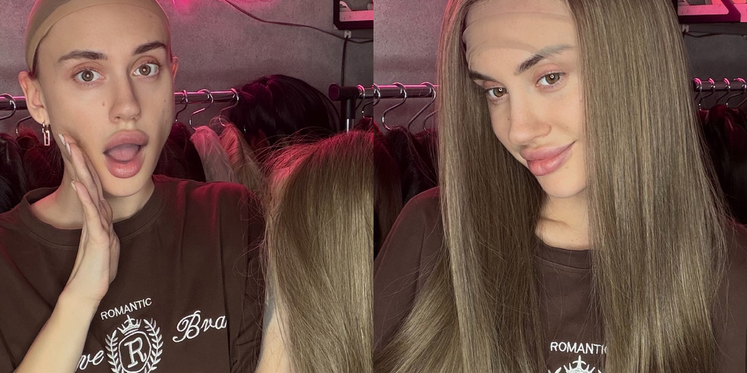 Средняя скорость роста волос у человека составляет примерно 1–1,5 сантиметра в месяц.