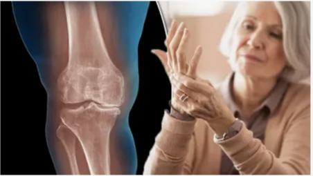 Артроз: причины, симптомы и современные методы лечения