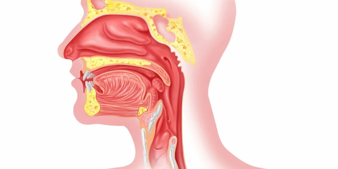 Слизь в горле и носоглотке: почему она появляется и как вернуть легкое дыхание