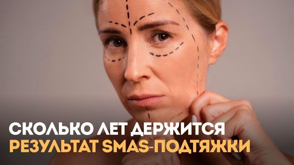 Сколько лет держится результат SMAS-подтяжки и от чего это зависит