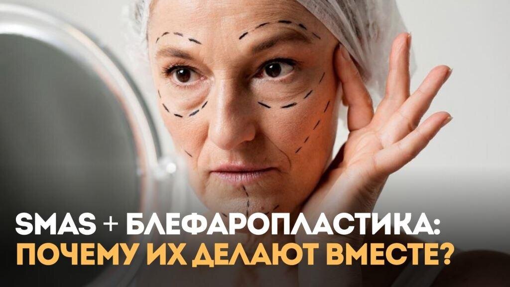 SMAS-подтяжка + блефаропластика: почему их часто делают вместе? 