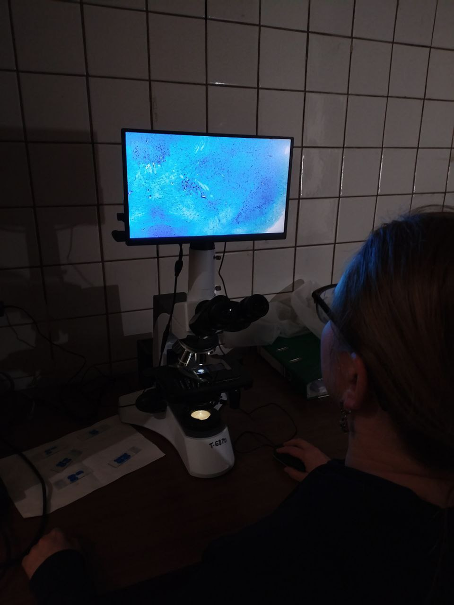 Вот, уже видны клетки на срезе мозга.