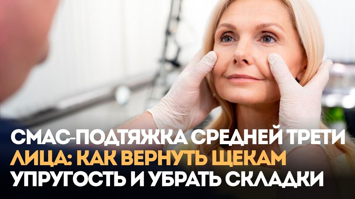 СМАС-подтяжка средней трети лица: как вернуть щекам упругость и убрать носогубные складки