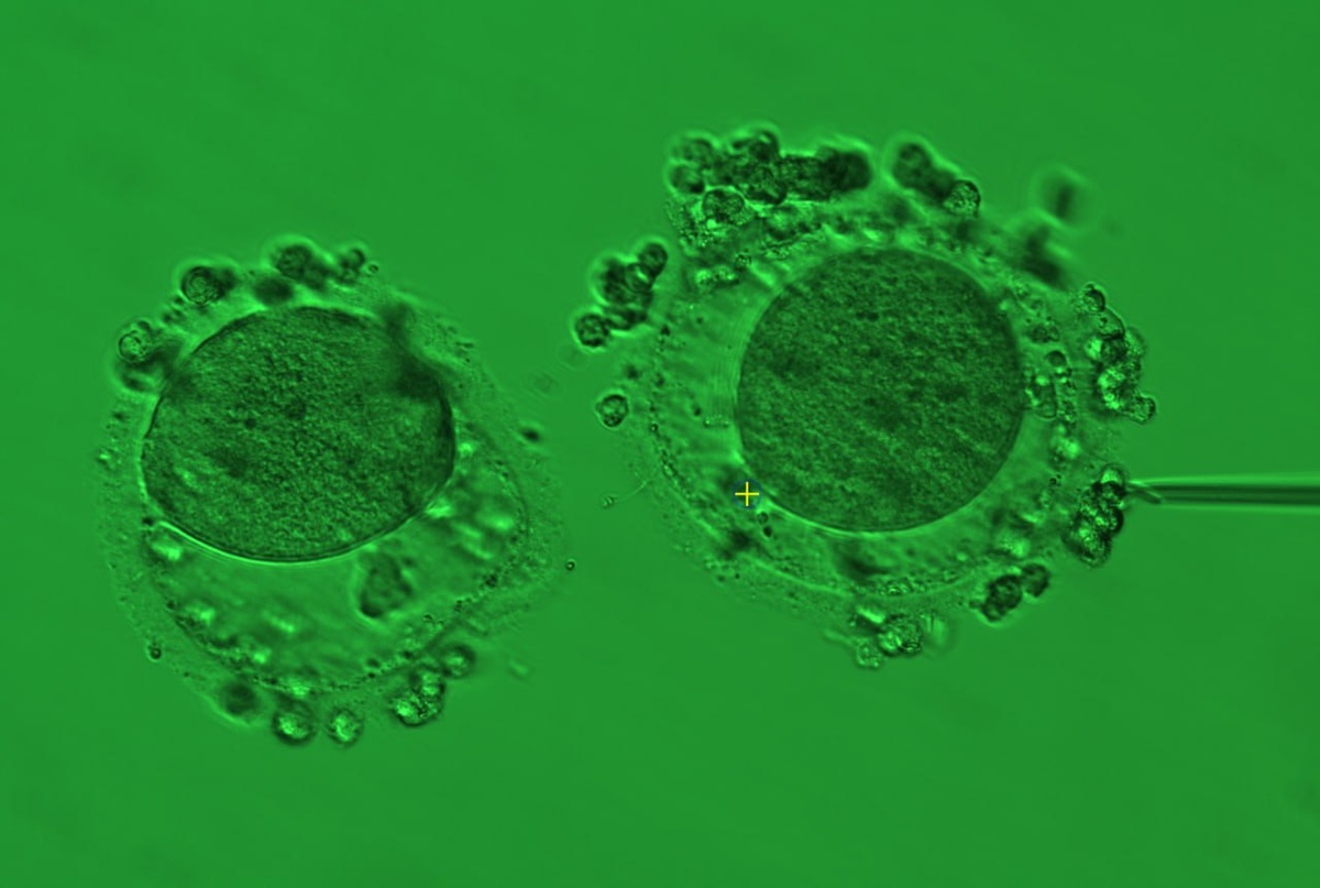 Ооциты с множественными морфологичекскими нарушениями