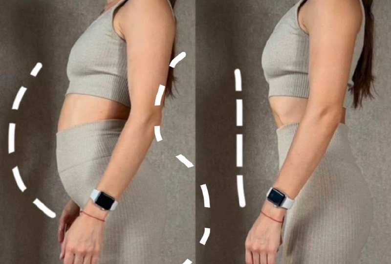 Что такое гиперлордоз и почему это важно