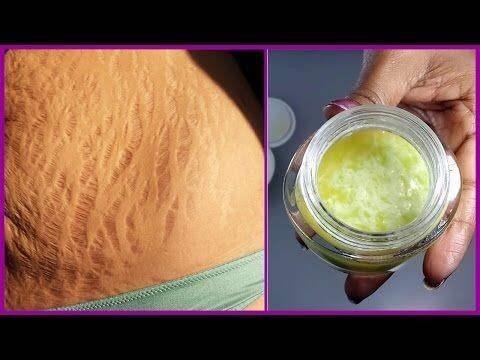 Сделай сам.