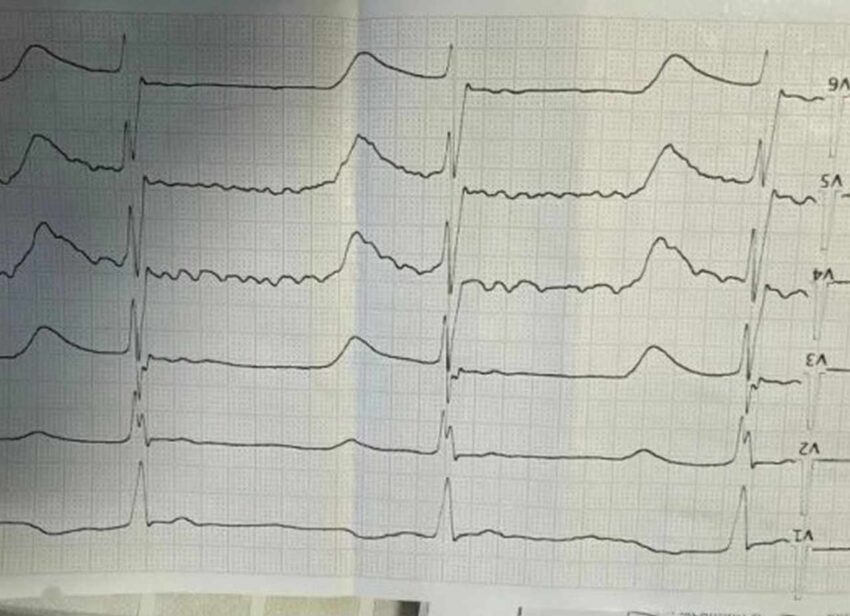    БУЗ ВО «ВГКБСМП №1.