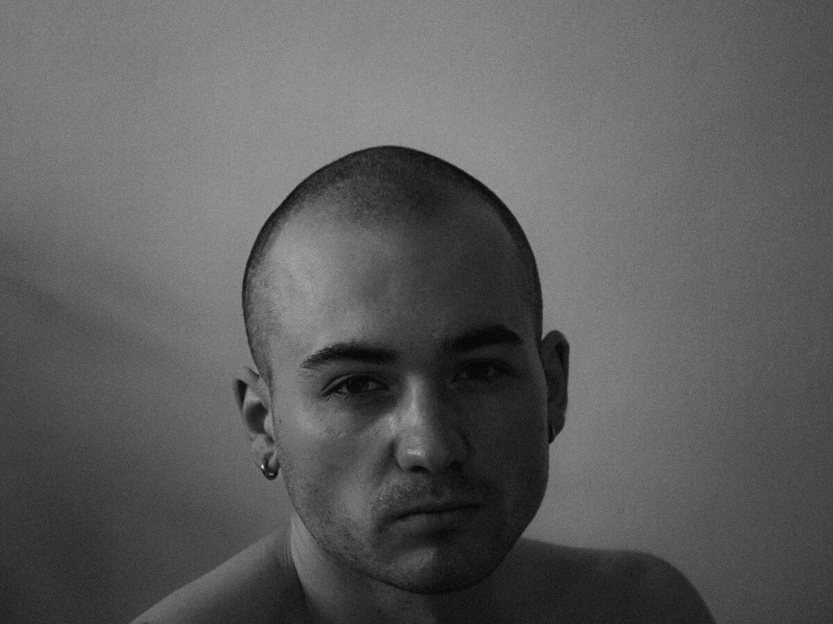    Пересадка волос без риска: почему анализы и врачи важнее цены MegaObzor.com