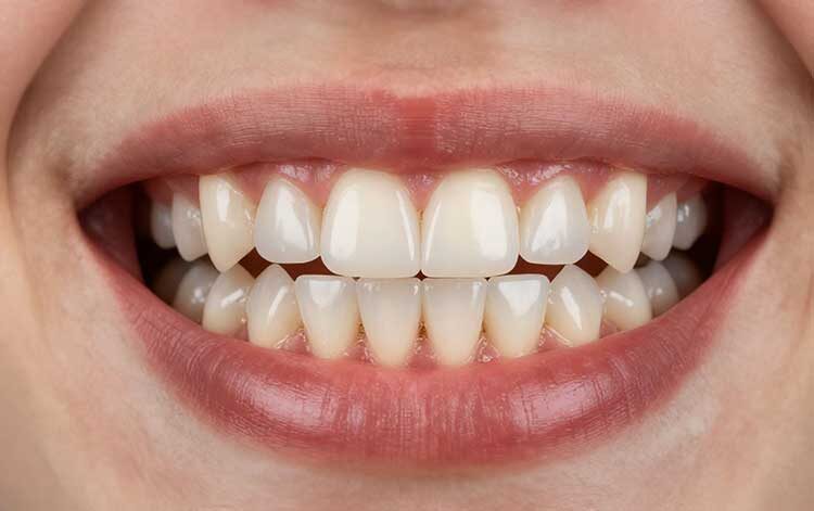 Протезирование зубов недорого