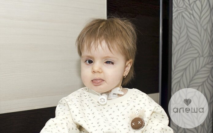 «Я помню, как брила дочку сама, как ее волосики падали мне на руки и слезы лились ручьем…