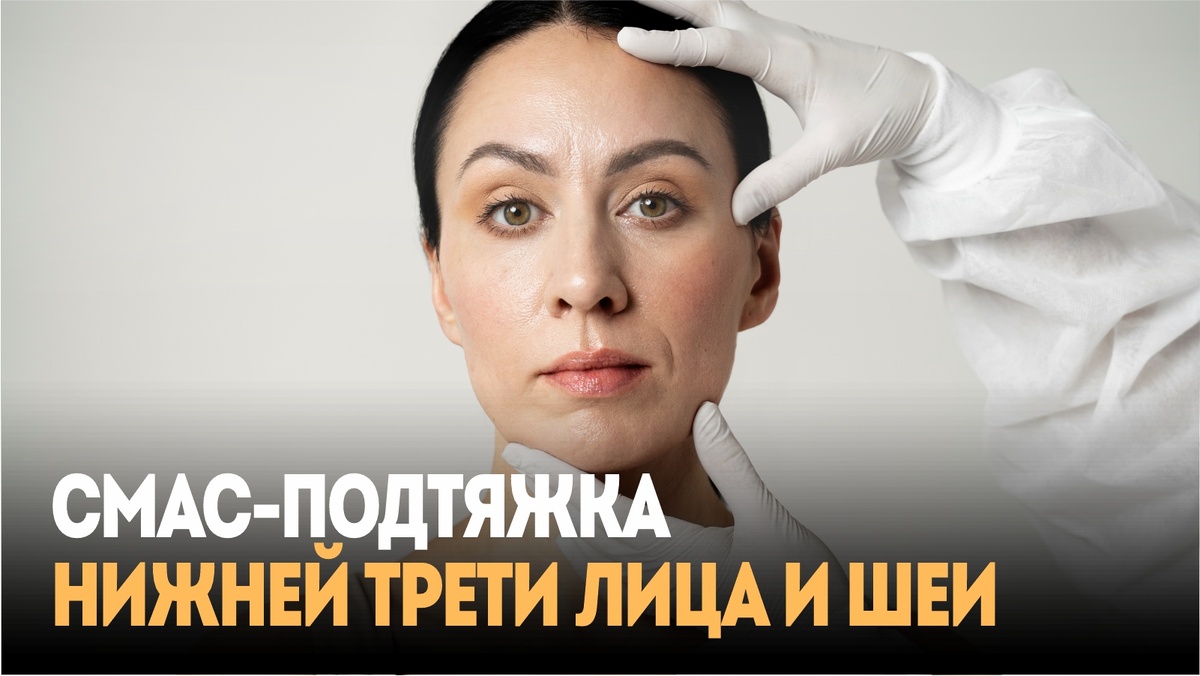 СМАС-подтяжка нижней трети лица и шеи: решение проблемы «брылей» и второго подбородка 
