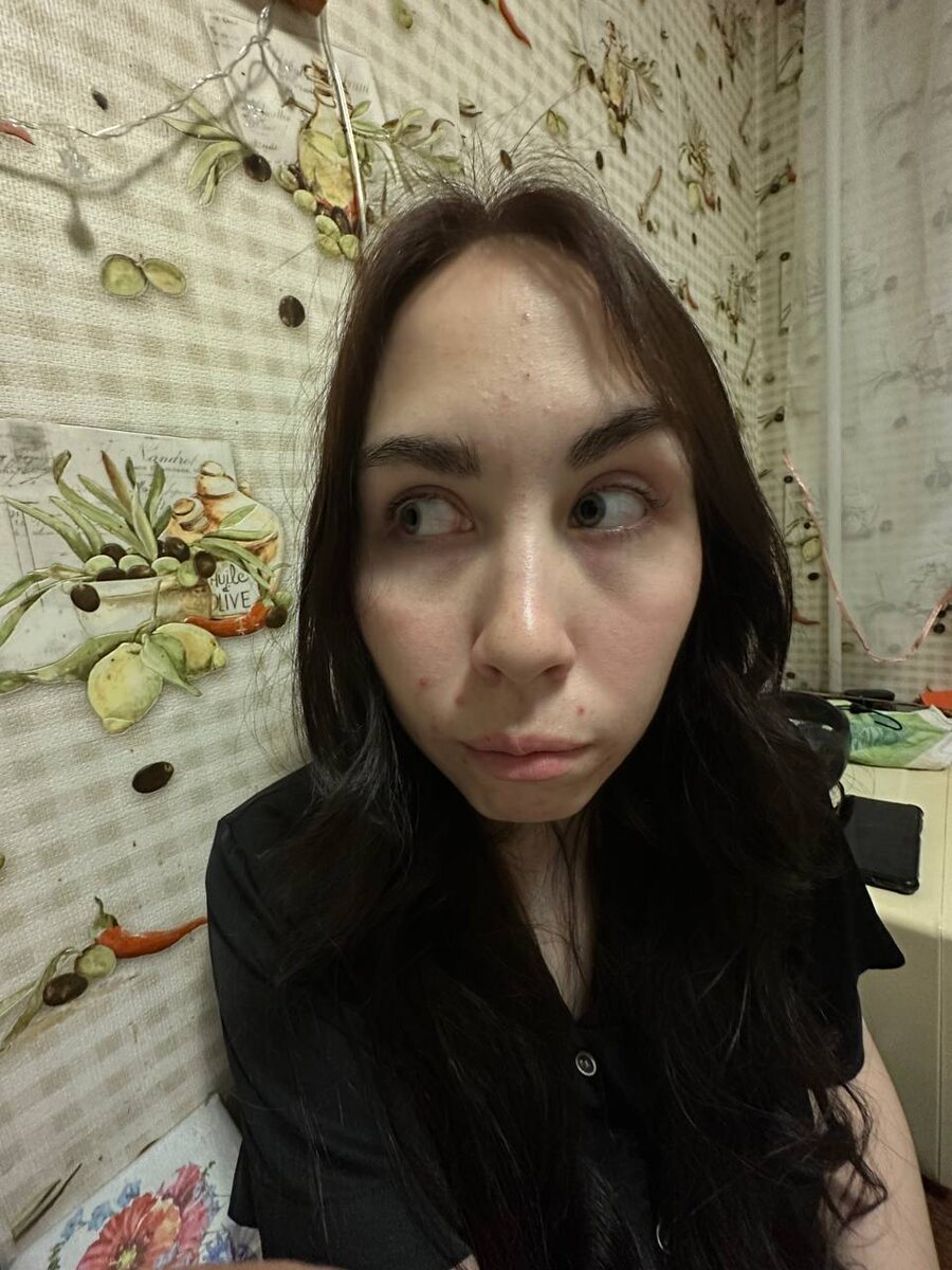 -2