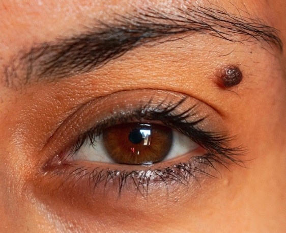 что означает родинка на левой  щеке у девушки