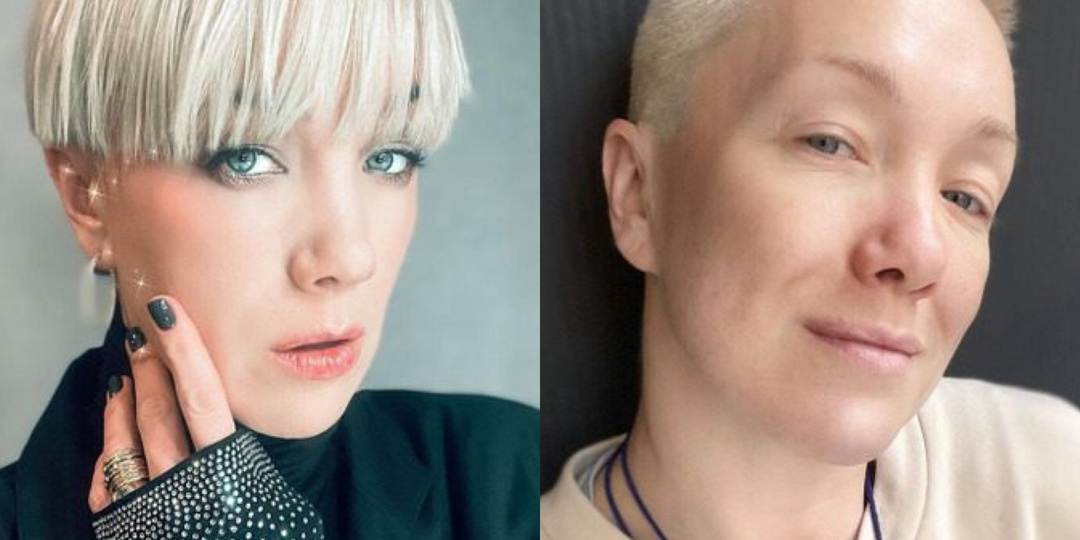 19 знаменитостей, изменивших свою внешность настолько, что их стало трудно узнать