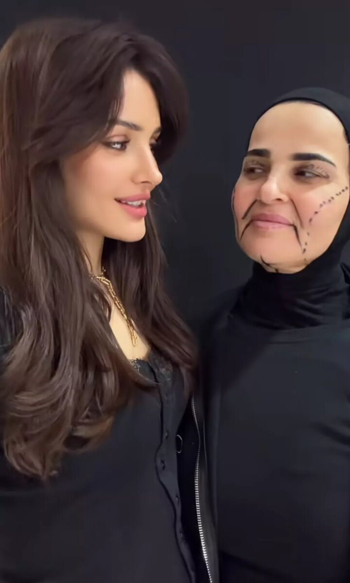 Мама Дины до операции📷
