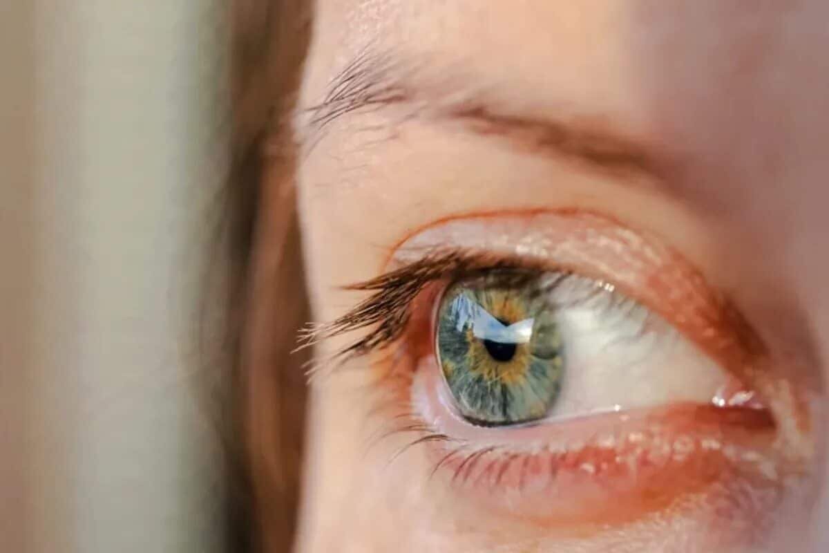    Ощущение сухости в глазах «предупредило» об аутоиммунном заболевании за несколько лет до постановки диагноза / © Автор неизвестен, PxHere