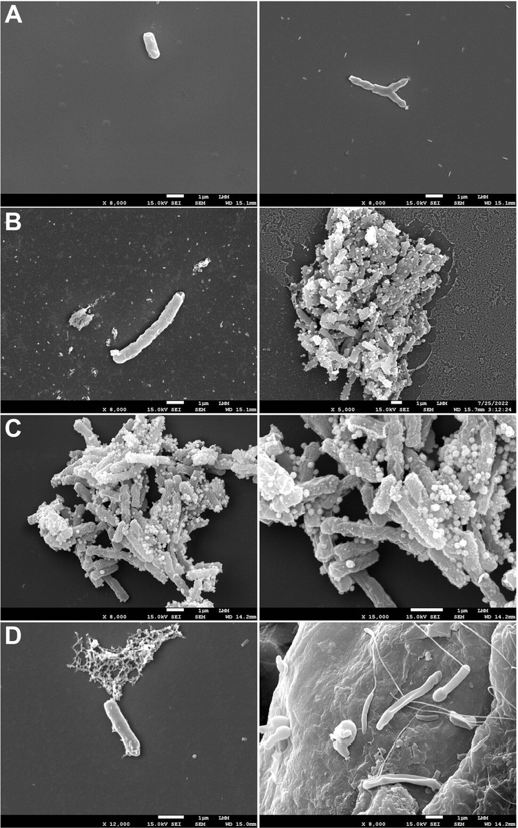 Морфология бацилл Mycobacterium tuberculosis после разных обработок: (A) Необработанные бациллы с нормальной стержнеобразной формой и целостной поверхностью. (B) Клетки, обработанные этамбутолом (EMB) показывают изменения поверхности и клеточный детрит, свидетельствующие о повреждении оболочки. (C) Клетки после изониазида (INH) имеют аморфные остатки и признаки лизиса, указывающие на разрушение структуры бацилл. (D) Клетки, обработанные FEP демонстрируют шероховатую поверхность, удлинённые и сплющенные бациллы, накопление нежизнеспособного материала и отсутствие делящихся клеток.    
 Источник: ACS Omega (2025). DOI: 10.1021/acsomega.5c08350  📷

