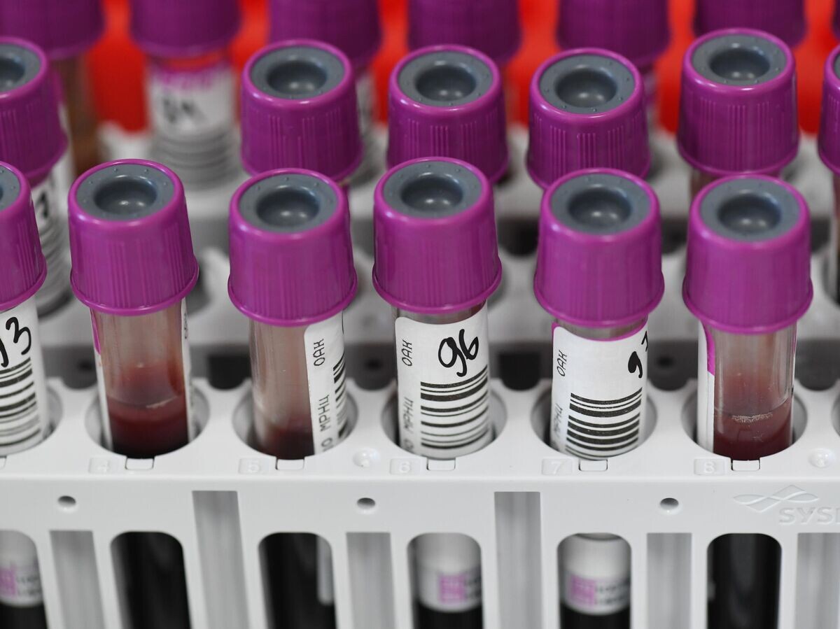    Пробирки с кровью пациентов в лаборатории по исследованию биохимического анализа крови© РИА Новости . Сергей Пятаков