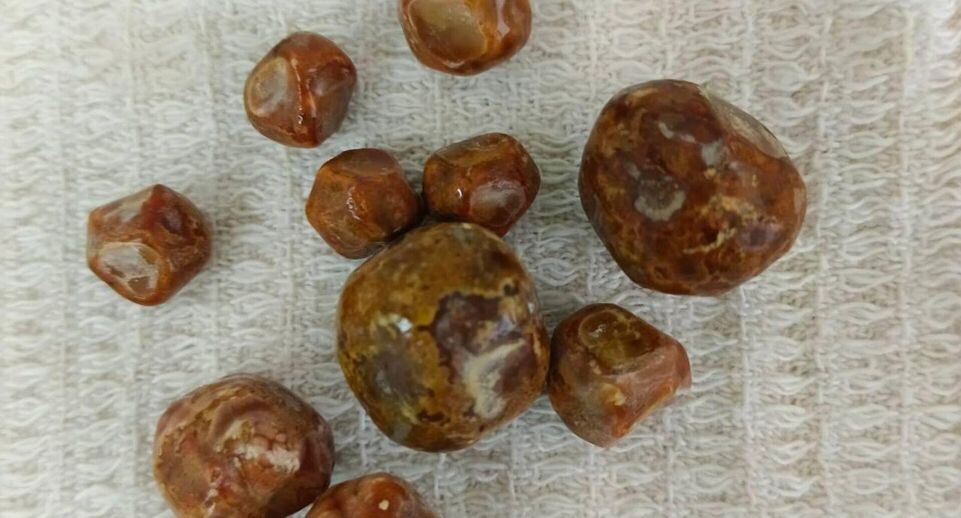    Балаковская городская клиническая больница