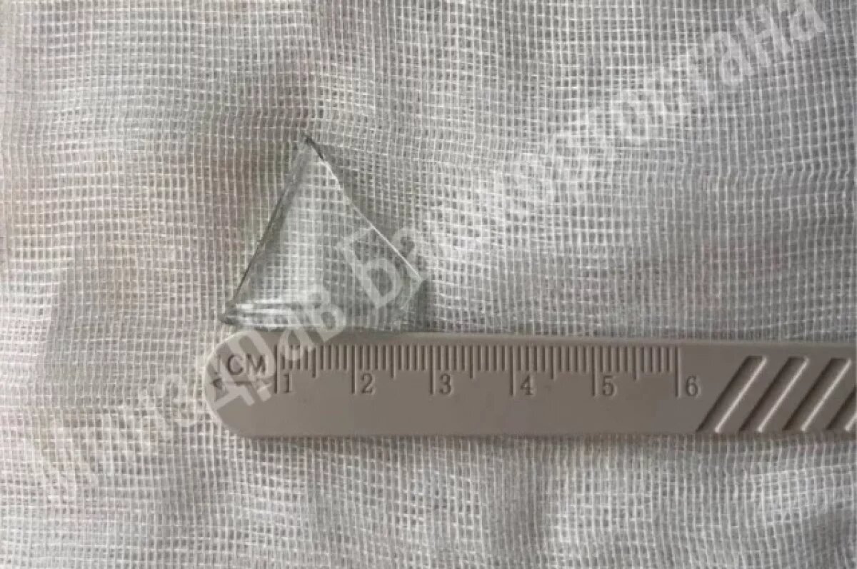    Уфимец проглотил кусок стекла бутылки, когда пил из нее