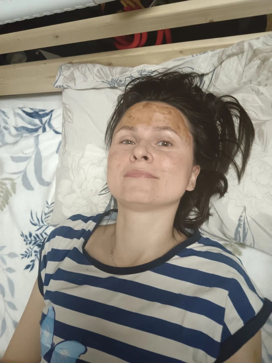 Намазала регенерантом. Только он и помогает.