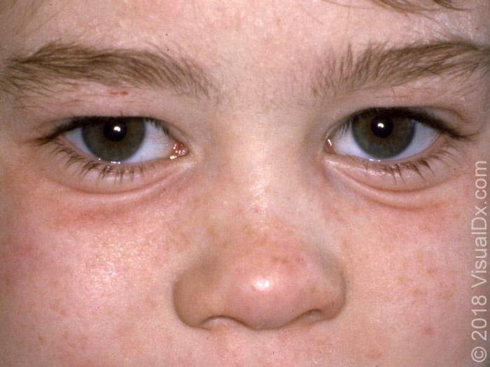 Линии Моргана