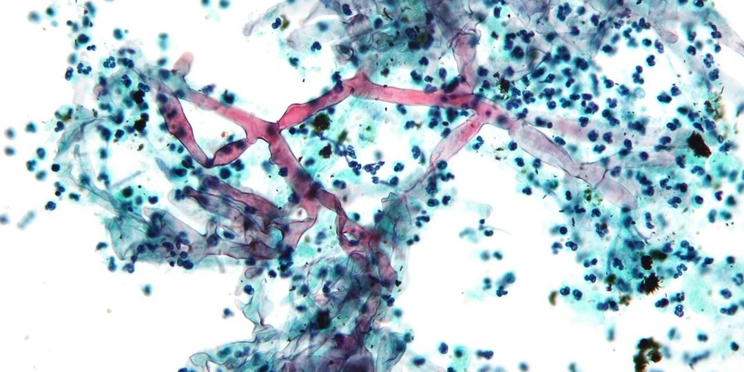 В России нашли новый способ включать «самоликвидаторы» раковых клеток