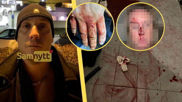    Шведский полицейский не пожалел сестру ради НАТО