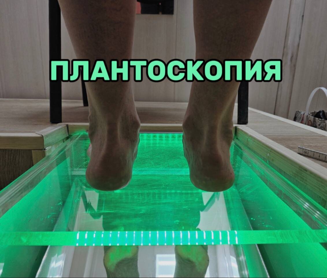 плантоскоп, с помощью которого делаются стельки