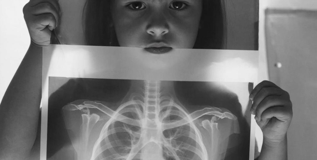 Рентген на всякий случай