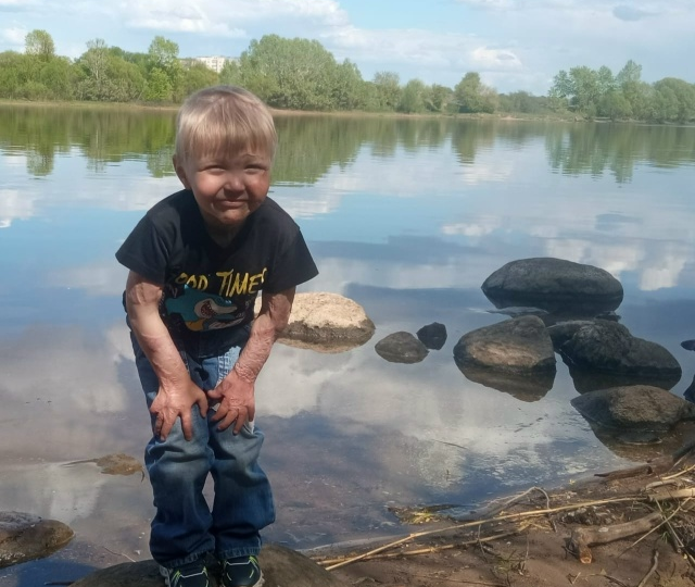 🔻 Каникулы и новогодние праздники позади, а вместе с ними — самый холодный период в г. Сочи. Это значит, что начинается пора реабилитаций д