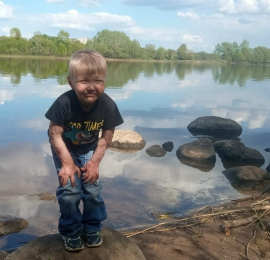 💙 Сбор для Руслана продолжается — нам очень нужна ваша помощь