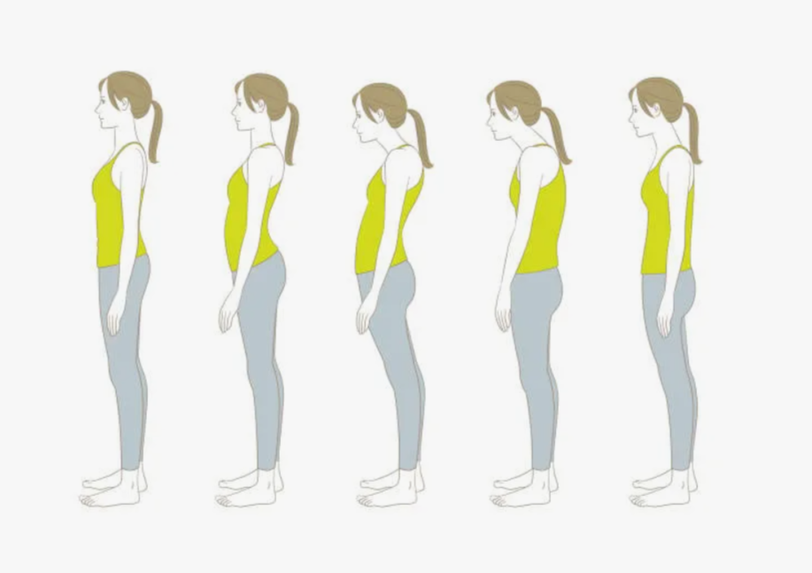 Осанка бывает разной. Упражнения в интернете — одни для всех. Чувствуете подвох?