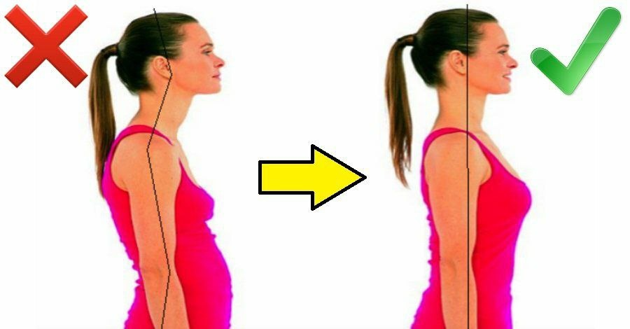 Осанка. Правильная и нет