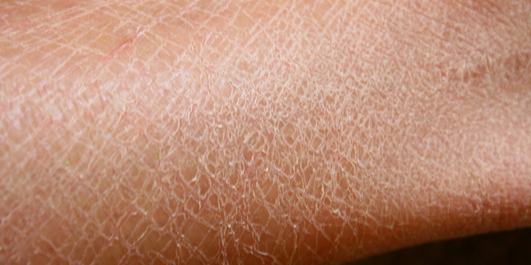 Кожа стала тонкой и блестящей — какие органы стоит проверить