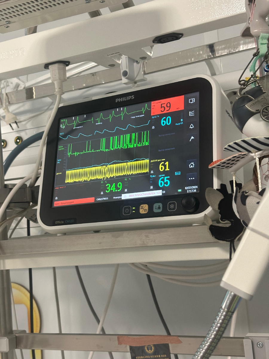 Мигало все, издавало жуткие звуки, а потом линия пульса стала прямая и мигал 0