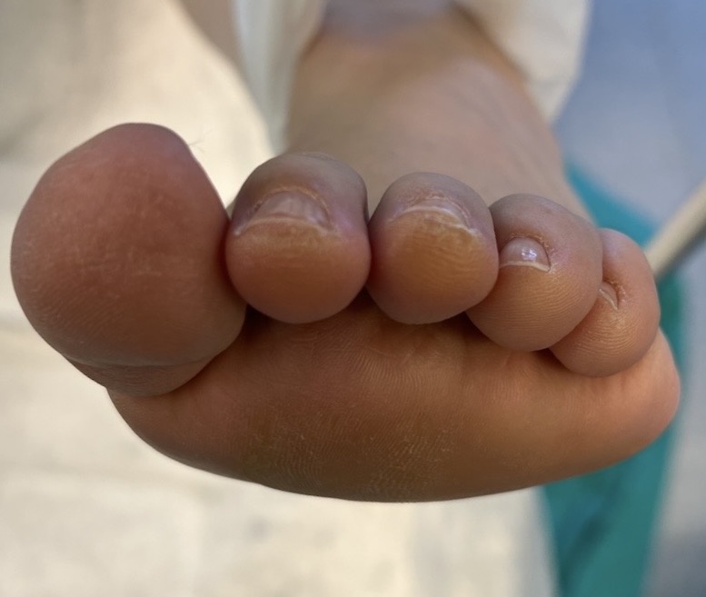 Круглая стопа