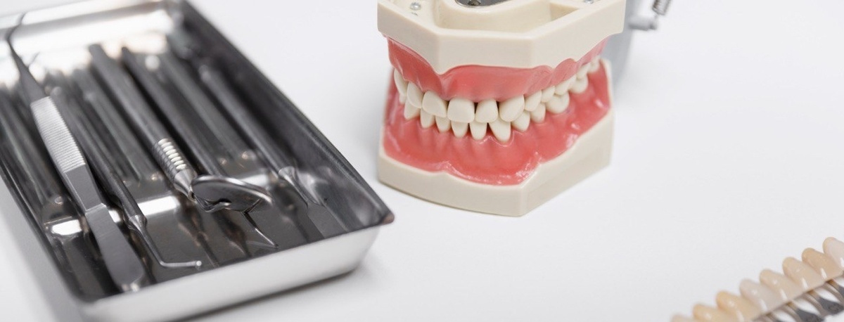 Протезирование жевательных зубов в Екатеринбурге