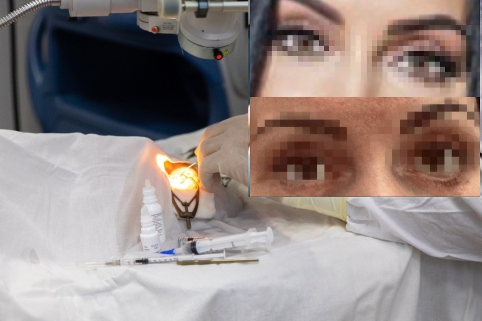 Женщина пережила несколько операций из-за неудачной блефаропластики. Фото: Дмитрий Ахмадуллин // Предоставлены пациенткой