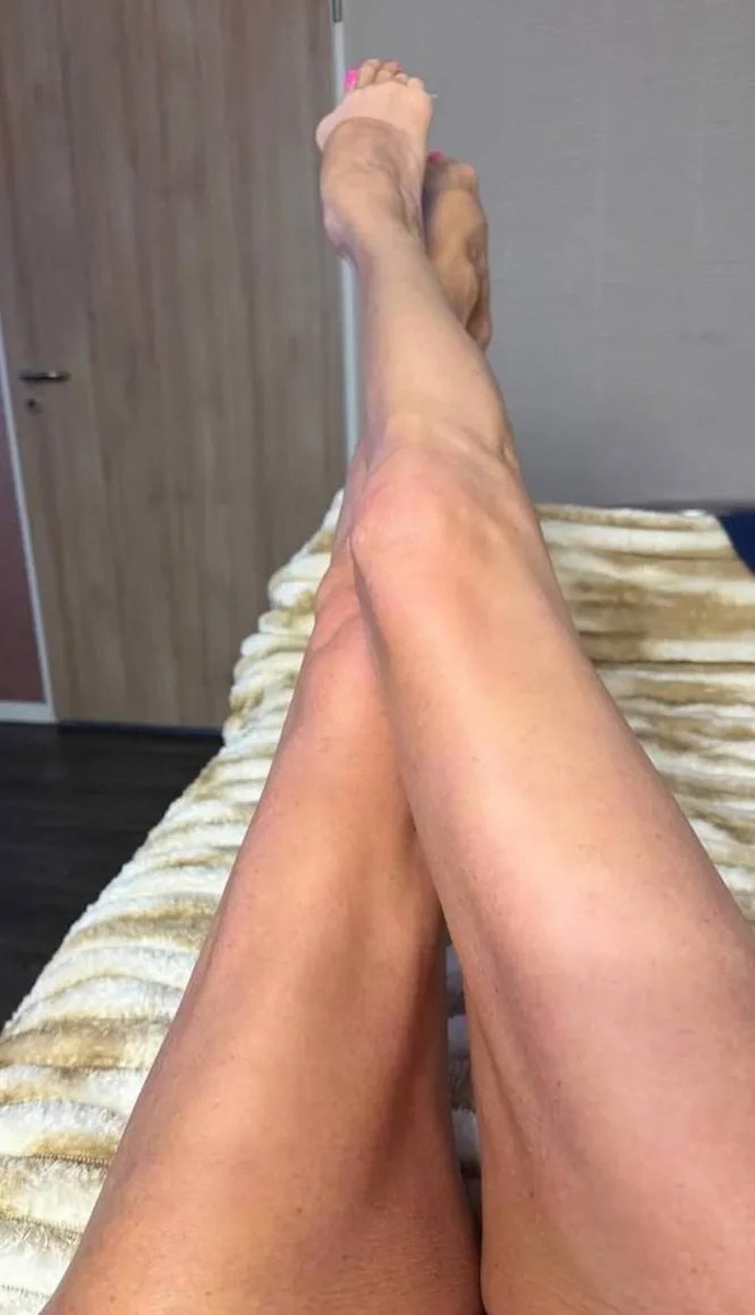    Артистка перенесла две операции. Фото: страница в социальной сети героя публикации