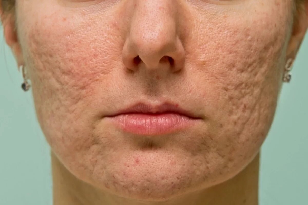    Учитывайте разницу между эстетическими процедурами и медицинскими вмешательствами.