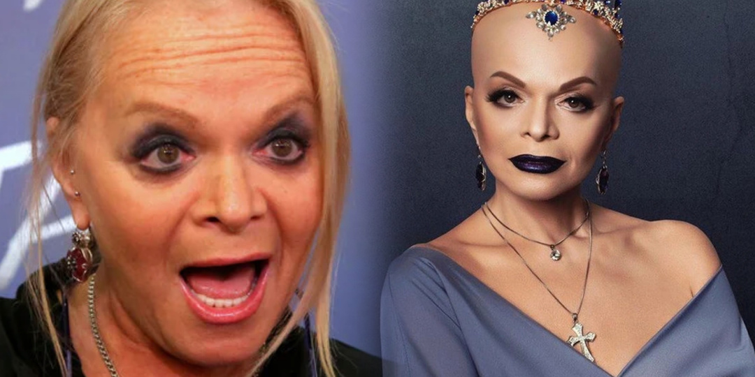 Лысая Лариса Долина удивила пользователей интернета своими фото