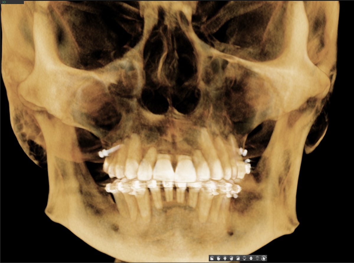 КТ от 2023 года