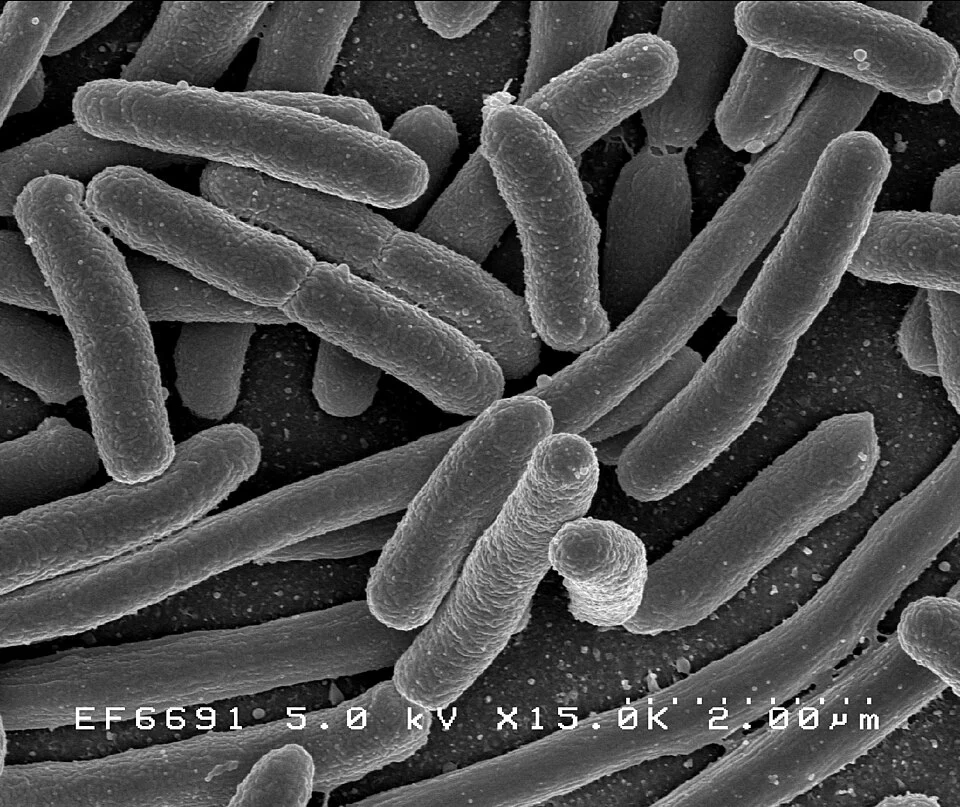    Бактерии Escherichia coli, более известные как кишечные палочки. Они могут быть не только вредными, но и полезными.
