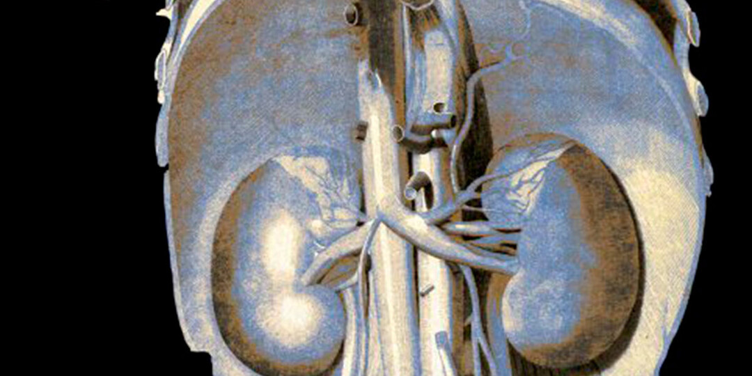 Назван фактор тяжелого поражения почек, не связанный с образом жизни