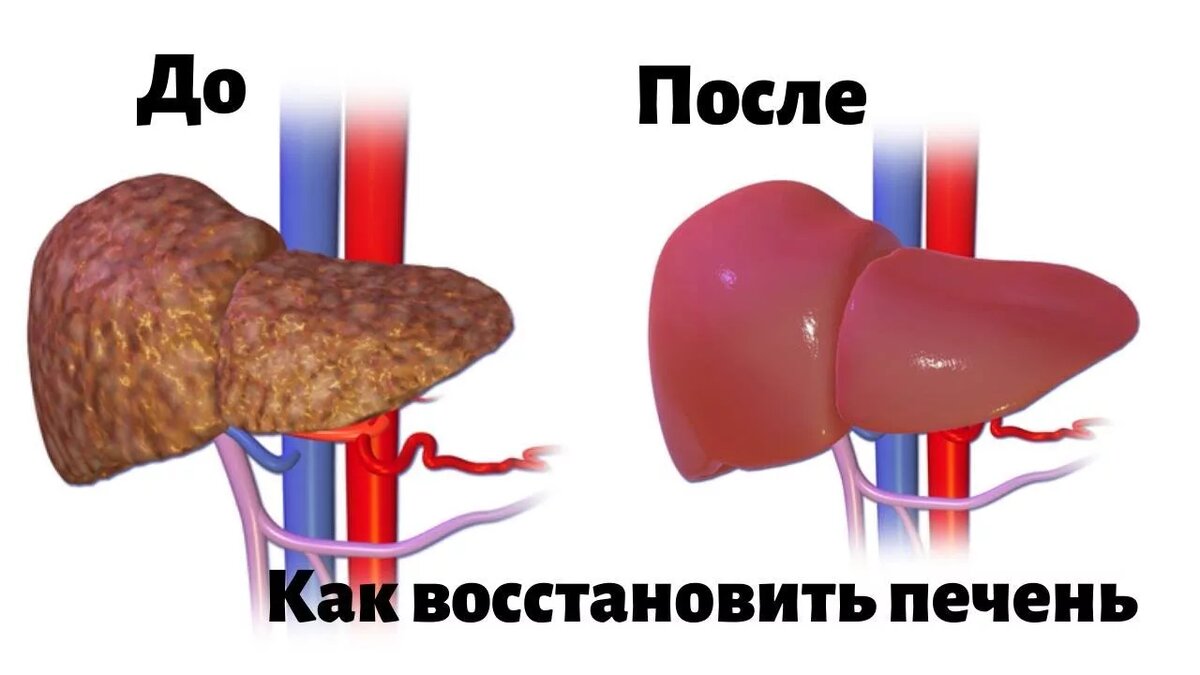 Если хочешь так же, прочитай эту статью доконца. Источник фото: https://clck.ru/3SCCyh