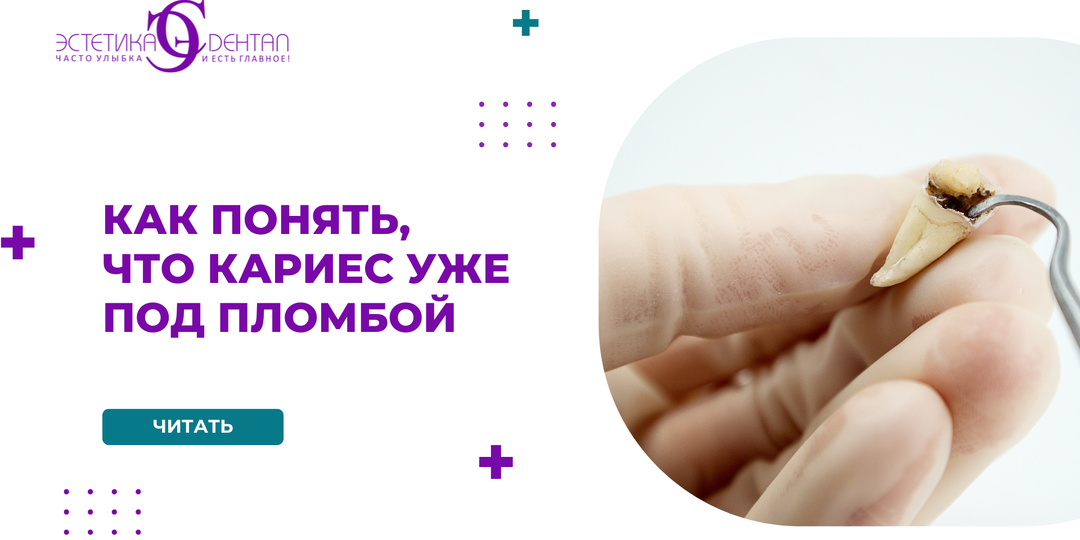 Как понять, что кариес уже под пломбой