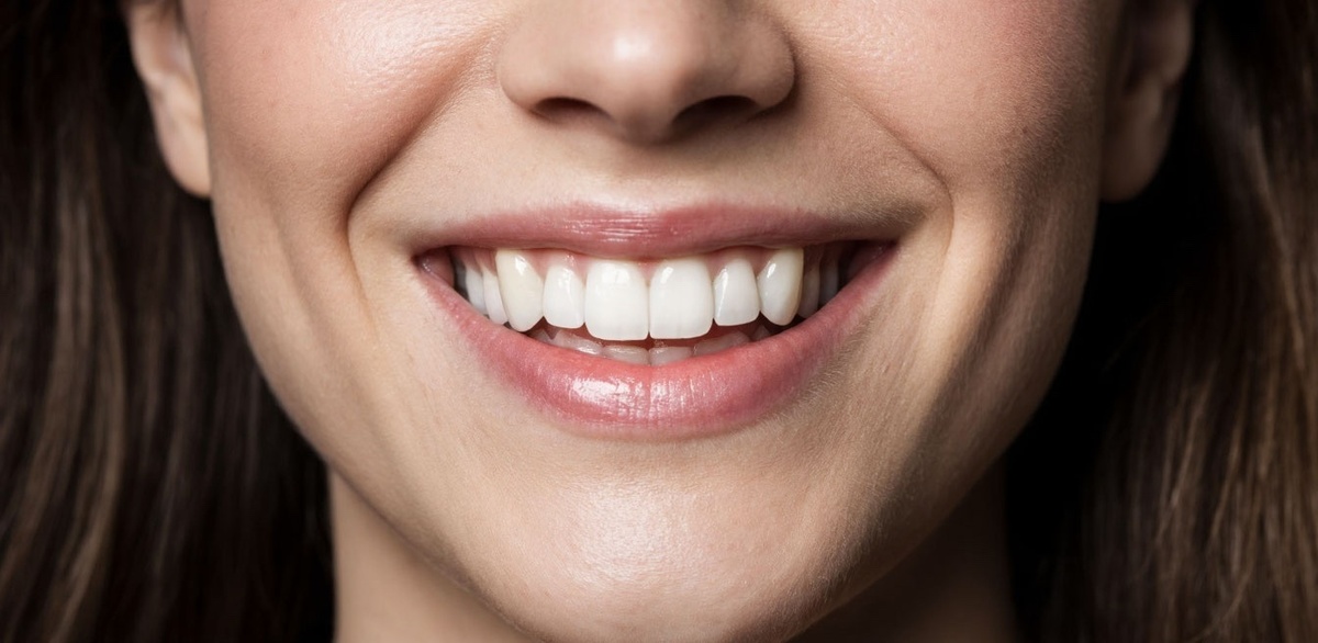 Весь рот за 3 дня